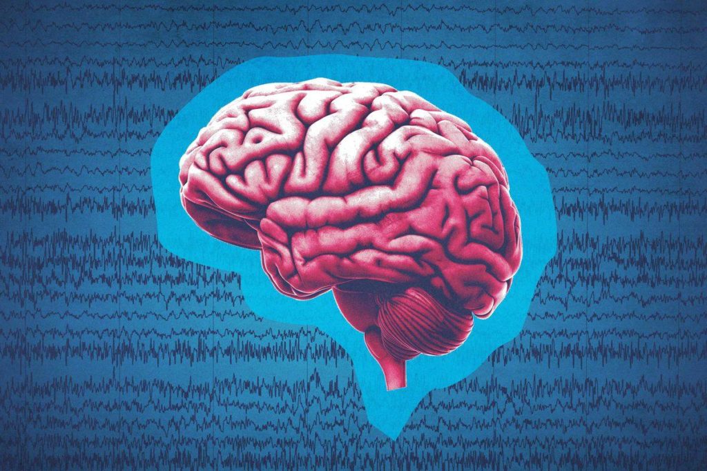 Major Epilepsy Study Offers Much-Needed Answers on 3 Lifesaving Seizure Drugs