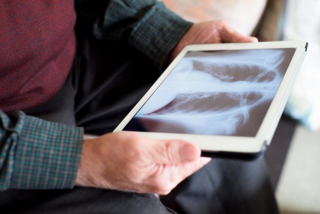 Image: Elderly patient looking at tablet screen showing ex-ray